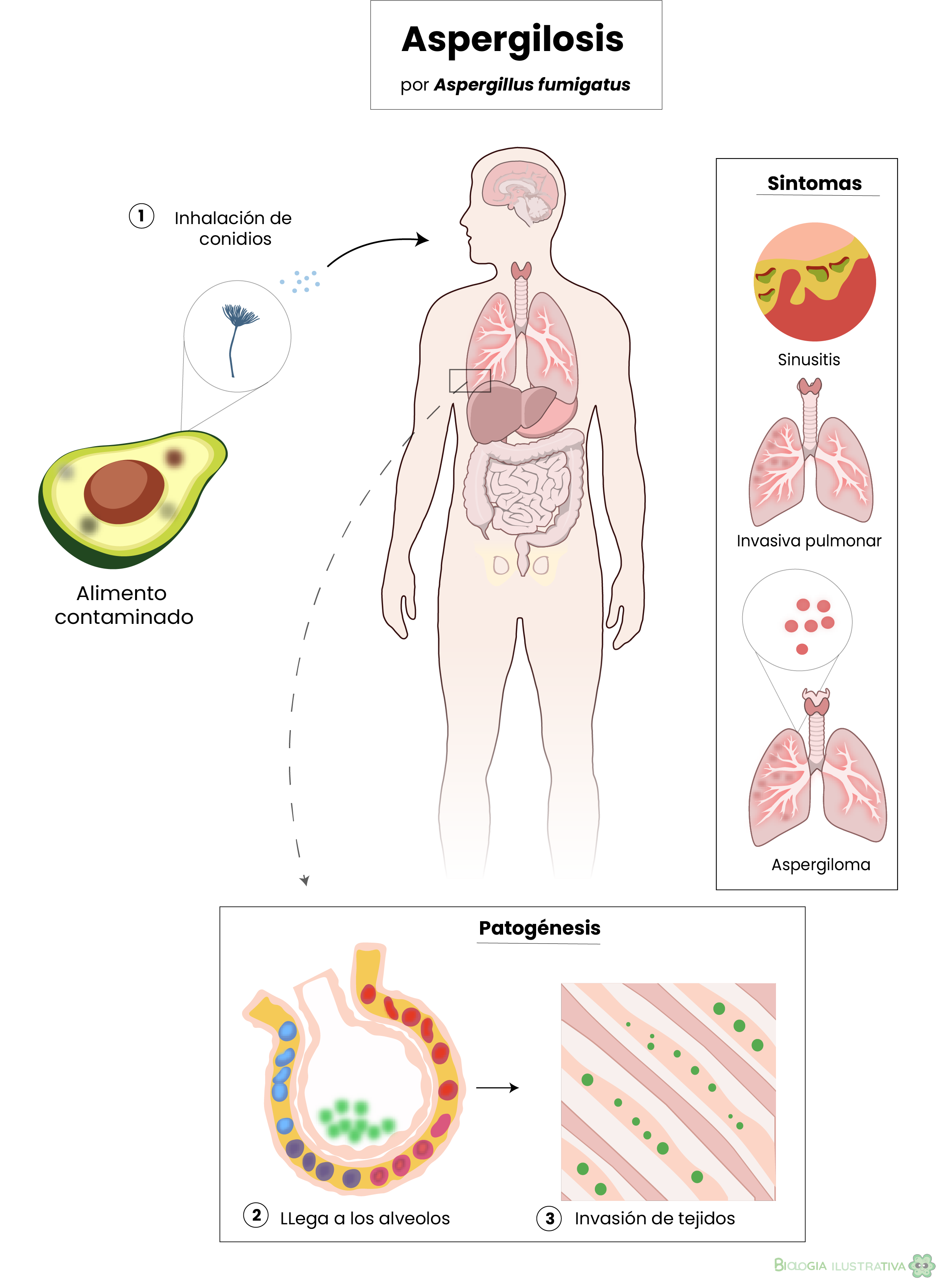 Aspergilosis ilustración científica